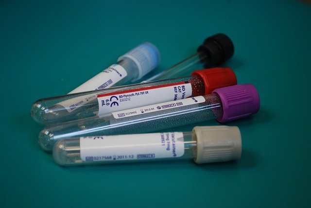 Spezifische Blutanalysen und kombinierte Therapien in der Krebsbehandlung